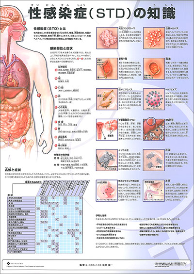 人体解剖図（人体図）　ミニポスター　性感染症（STD)の知識