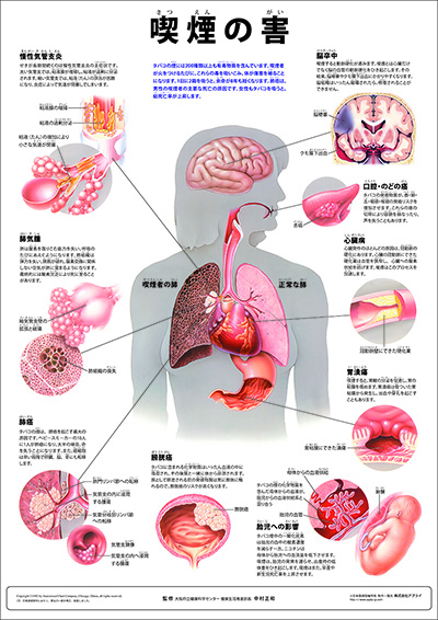 人体解剖図（人体図）　ミニポスター　喫煙の害