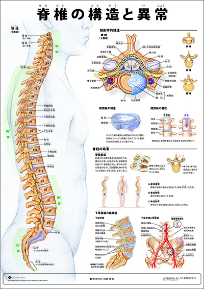 人体解剖図（人体図）　ミニポスター　脊椎の構造と異常