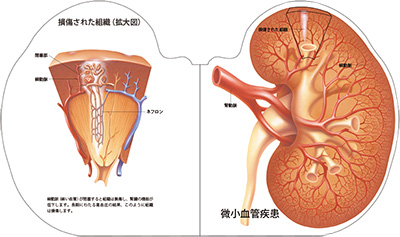 型抜き絵本 腎臓 05-06ページ