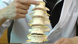 椎間板ヘルニアと変形性脊椎症モデル:動画