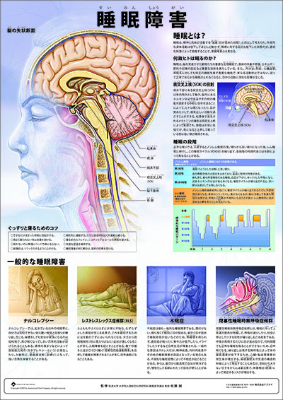 人体解剖図（人体図）　ミニポスター　睡眠障害