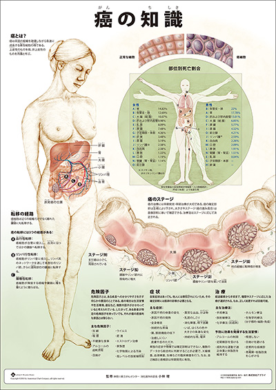 人体解剖図（人体図）　ミニポスター　癌の知識