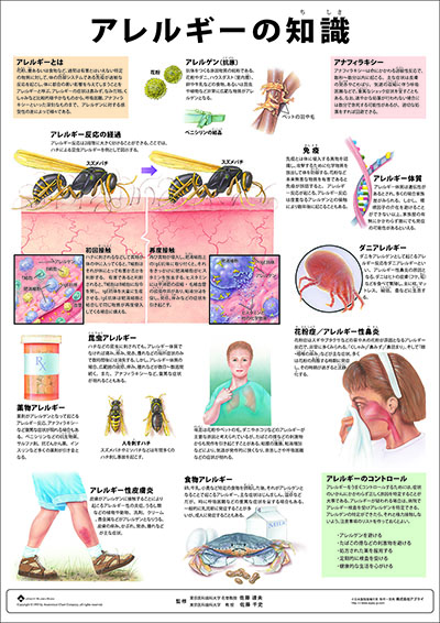 人体解剖図（人体図）　ミニポスター　アレルギーの知識