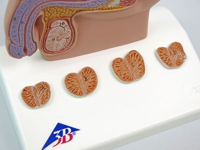 前立腺肥大,前立腺がんなど