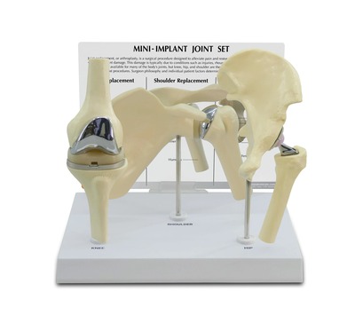 ミニ人工関節セットの全体像。左から人工膝関節・人工肩関節・人工股関節の模型