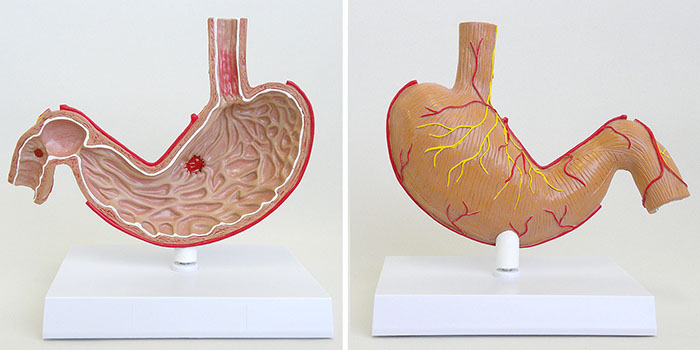 潰瘍付き胃模型の全体像。胃潰瘍や十二指腸潰瘍が確認できる。