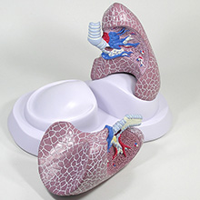 COPD（慢性閉塞性肺疾患）の肺模型のアップ