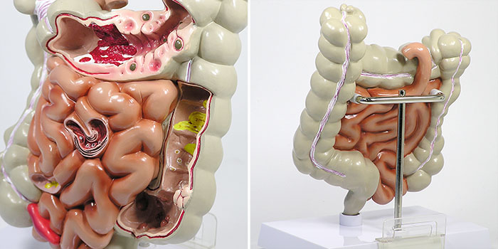 小腸・大腸の諸疾患を示す模型の全体像
