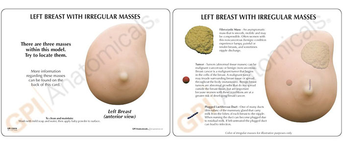 乳房触診モデルの全体像。内部のしこりの位置が示されている。