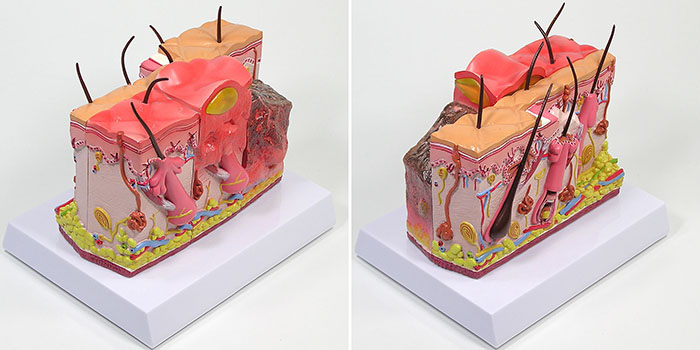 皮膚火傷モデルの全体像（火傷面）