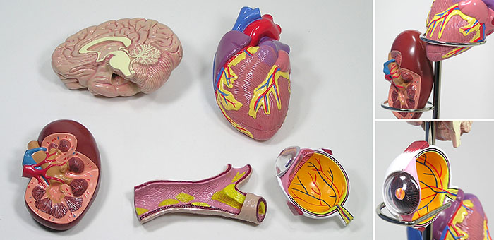 心臓、腎臓、動脈硬化の各模型のアップ
