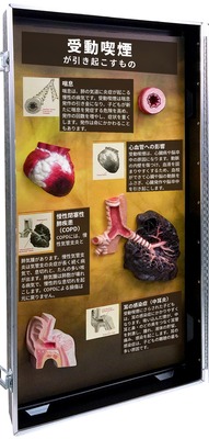 3D模型ディスプレイ 受動喫煙の害の左側のパネル。立体模型4個と日本語の解説