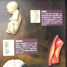 3Dディスプレイ　喫煙の害　詳細画像