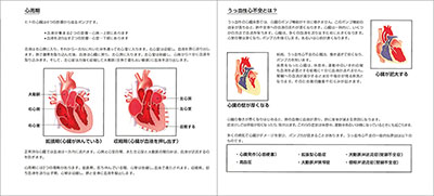 型抜き絵本 うっ血性心不全 01-02ページ