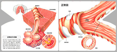 型抜き絵本 喘息と慢性閉塞性肺疾患（COPD） 01-02ページ