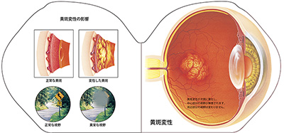型抜き絵本 視覚器 05-06ページ