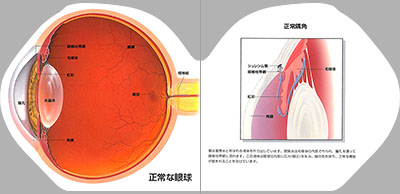 型抜き絵本 緑内障の知識 01-02ページ