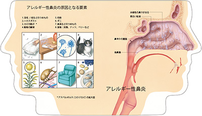 型抜き絵本 鼻腔と副鼻腔疾患 05-06ページ