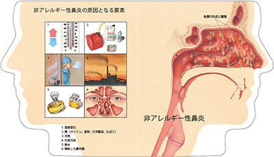 型抜き絵本 鼻腔と副鼻腔疾患 07-08ページ