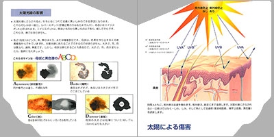 型抜き絵本 皮膚の病気 09-10ページ
