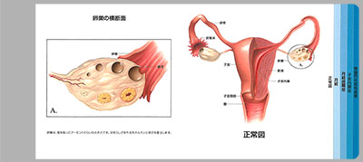 型抜き絵本 女性性器と痛み 01-02ページ
