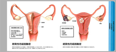 型抜き絵本 女性性器と痛み 05-06ページ