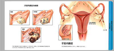 型抜き絵本 女性性器と痛み 07-08ページ