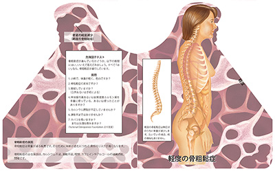 型抜き絵本 骨粗鬆症 03-04ページ