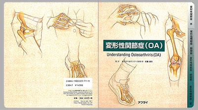 型抜き絵本 変形性関節症（OA） 表紙