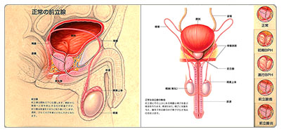 型抜き絵本 前立腺 01-02ページ