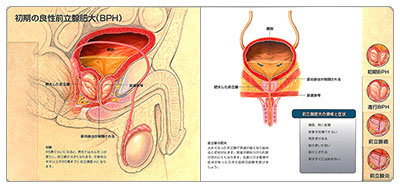 型抜き絵本 前立腺 03-04ページ