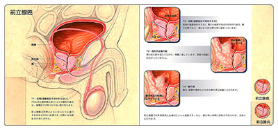 型抜き絵本 前立腺 07-08ページ