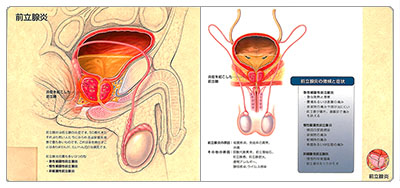 型抜き絵本 前立腺 09-10ページ