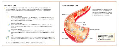 型抜き絵本 2型糖尿病と心血管疾患 03-04ページ