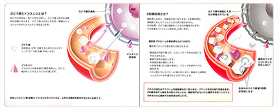 型抜き絵本 2型糖尿病と心血管疾患 05-06ページ