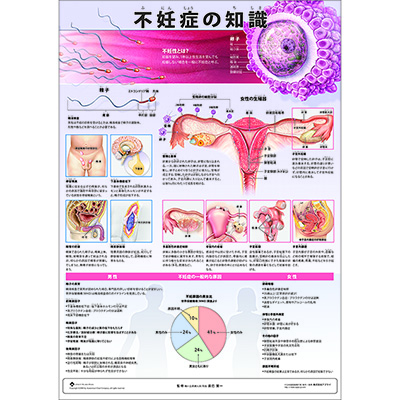 （医学ポスター）　ミニポスター　不妊症の知識
