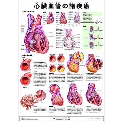 （医学ポスター）　ミニポスター　心臓血管の諸疾患