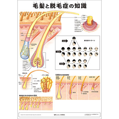 （医学ポスター）　ミニポスター　毛髪と脱毛症の知識
