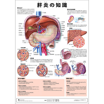 （医学ポスター）　ミニポスター　肝炎の知識