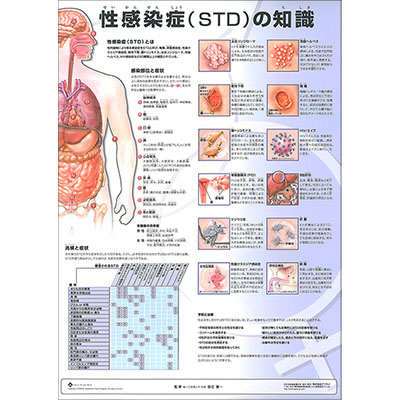 （医学ポスター）　ミニポスター　性感染症（STD)の知識