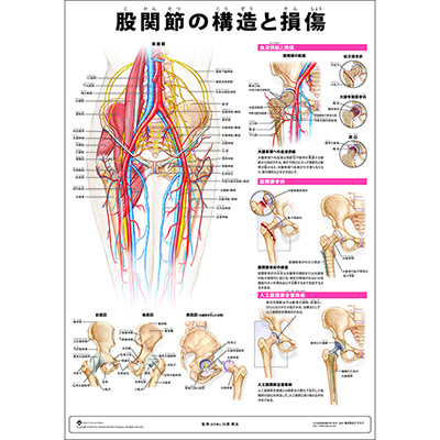 （医学ポスター）　ミニポスター　股関節の構造と損傷