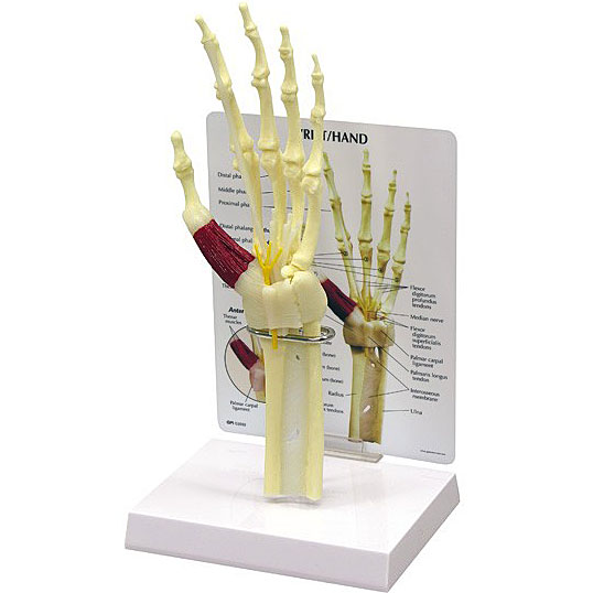 人体模型　手と手首/手根管症候群表示　GPI Anatomicals