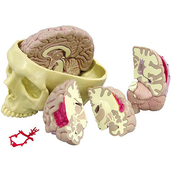 人体模型　脳/頭蓋,諸疾患付　GPI Anatomicals