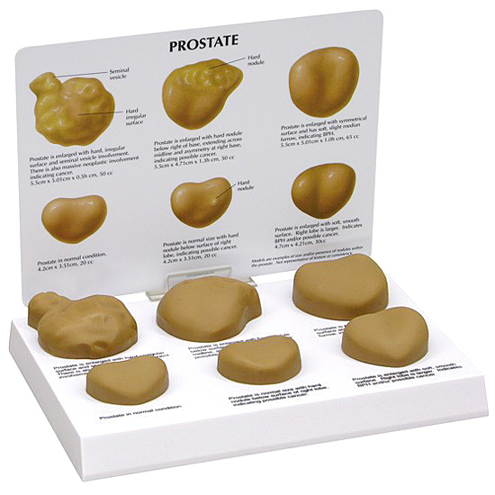 医学模型　前立腺疾患　GPI Anatomicals
