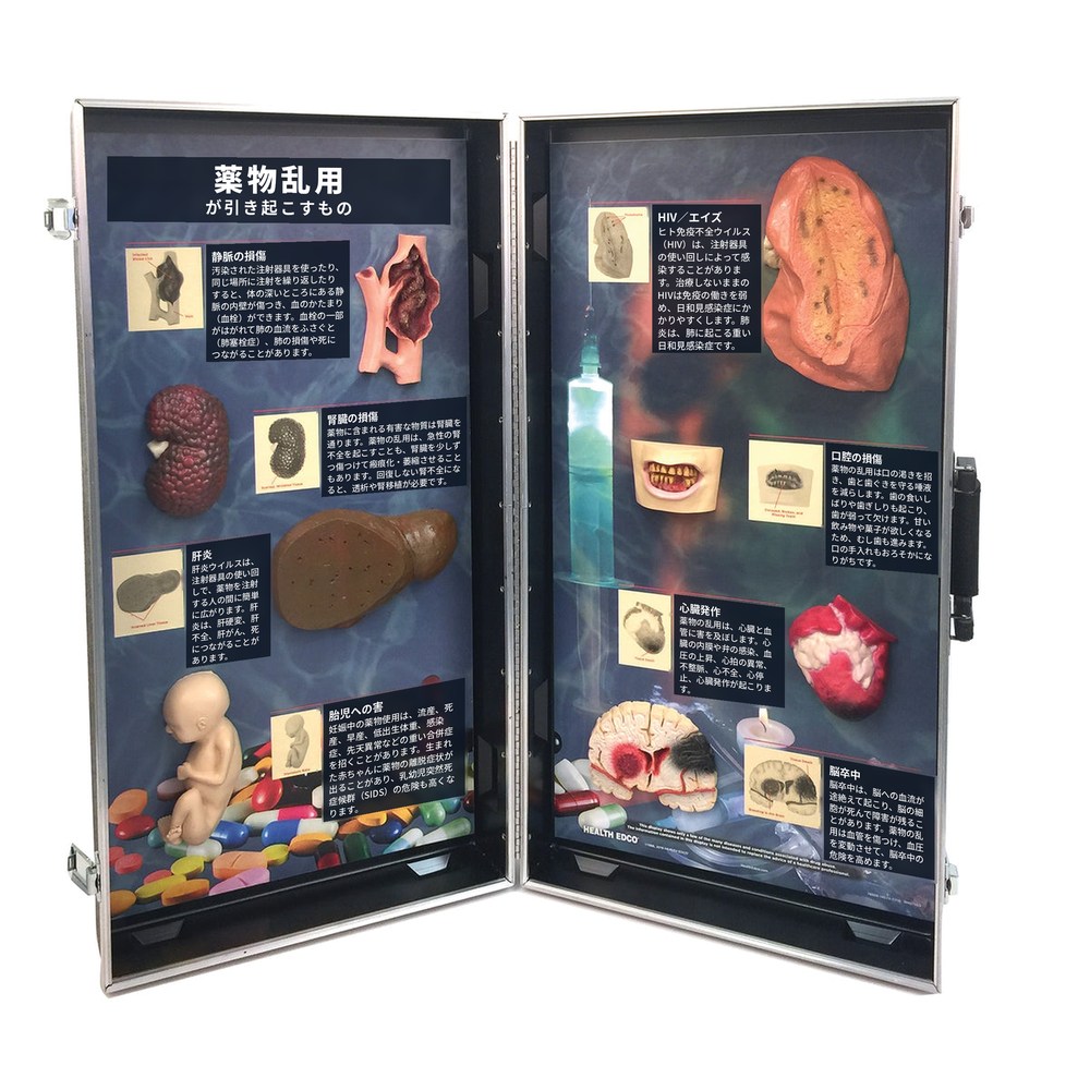 3D模型ディスプレイ　薬物乱用の害
