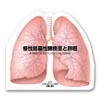 慢性閉塞性肺疾患と肺癌