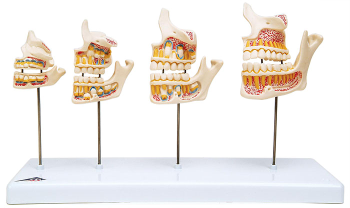 人体模型　歯の成長過程/実物大　詳細画像
