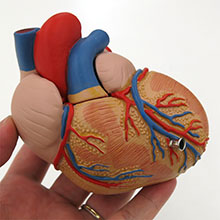 医学模型　心臓/左心室肥大　詳細画像