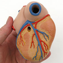 医学模型　心臓/左心室肥大　詳細画像